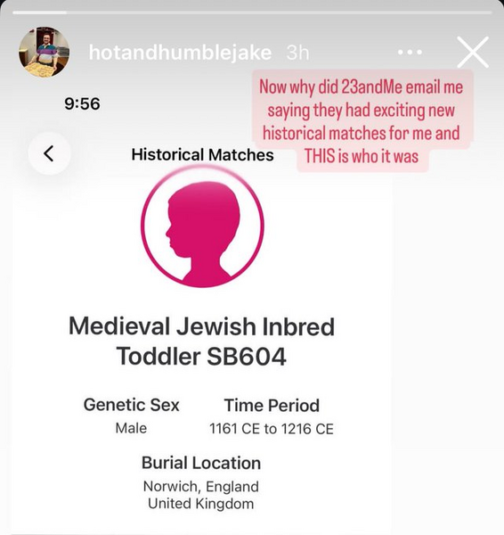 File:Jewish Inbred Toddler.png